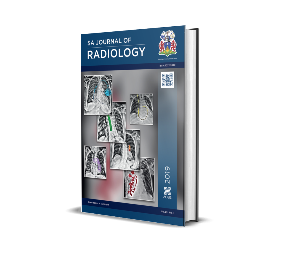 SA Journal of Radiology AOSIS